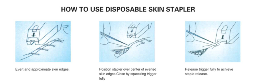 how to use skin stapler