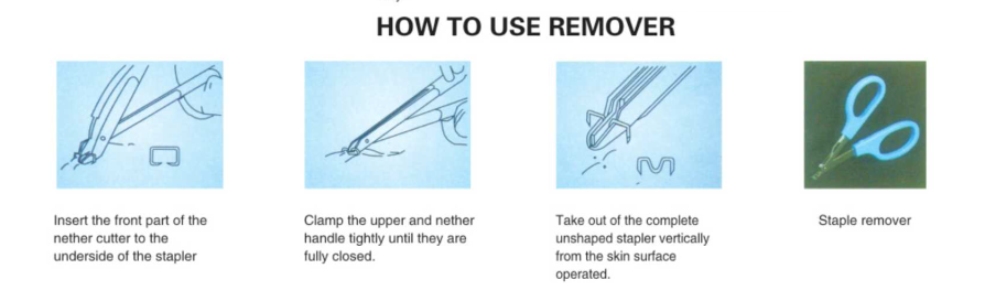 how to use remover