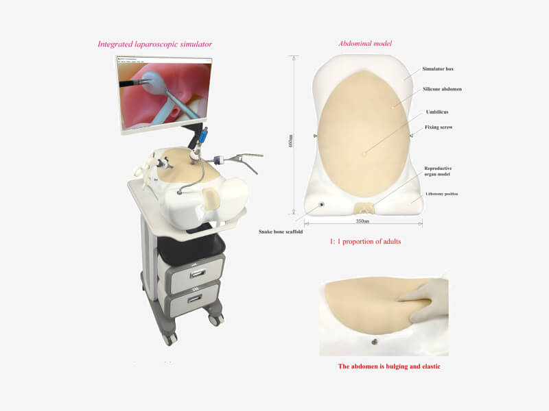 Analysis of Advantages of Laparoscopic Simulator