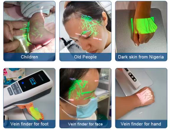 vein finder application