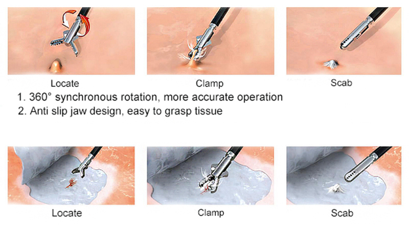 endoscope sampling forceps features