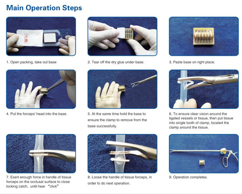  Hem-o- lok operation steps