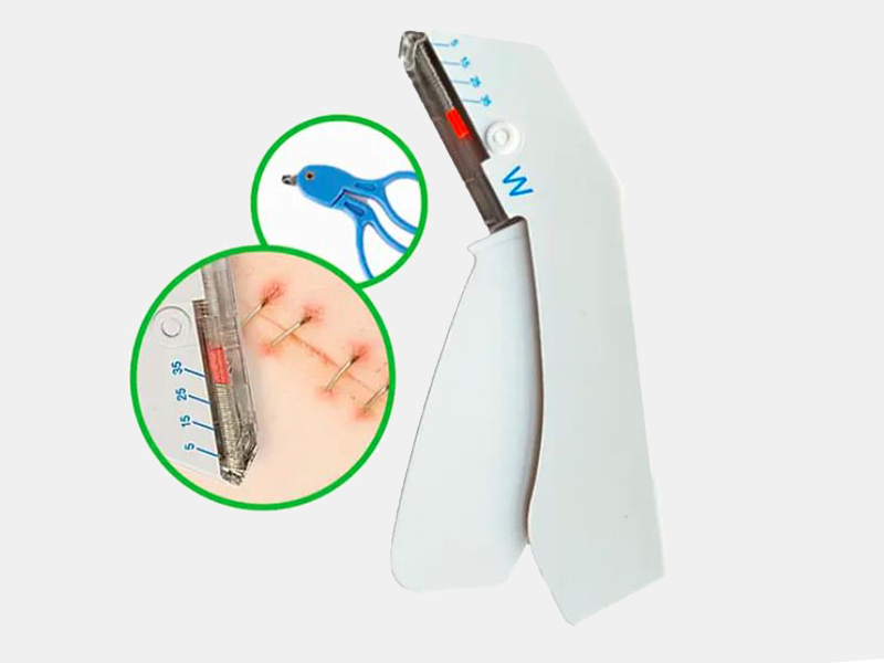 internal surgical staples